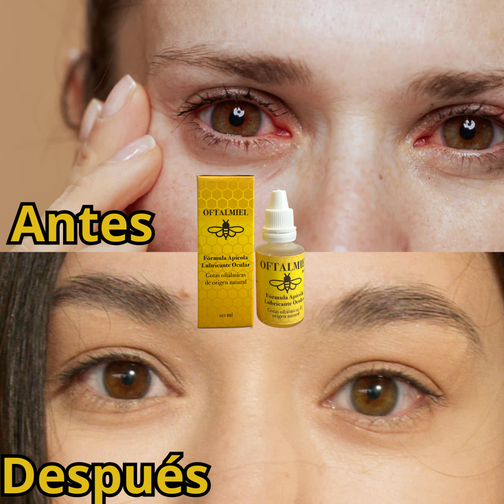OFTALMIEL PRO™ ⁓ Tratamiento Natural Avanzado
