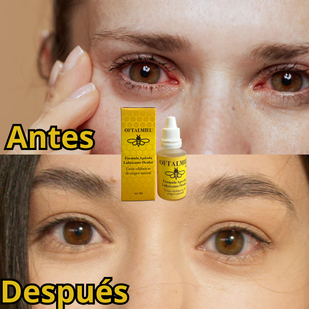 OFTALMIEL PRO™ ⁓ Tratamiento Natural Avanzado