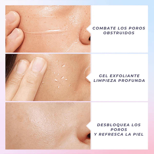 ✨°QUARXERY Gel Exfoliante Premium ⁓ Limpiador Hidratante con Nicotinamida°